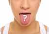 Tongue Diseases