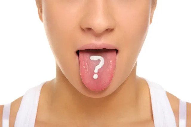 Tongue Diseases